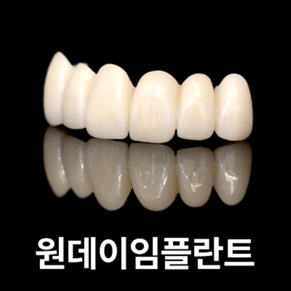원데이 임플란트 진료